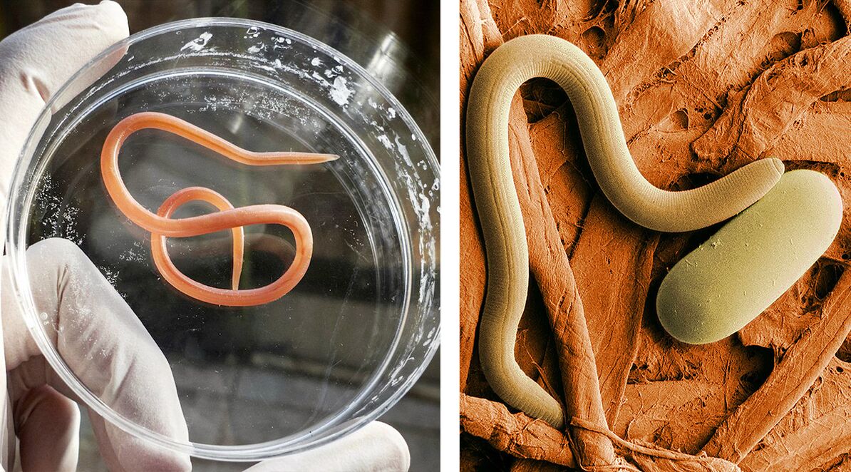 parazitov v ľudskom tele