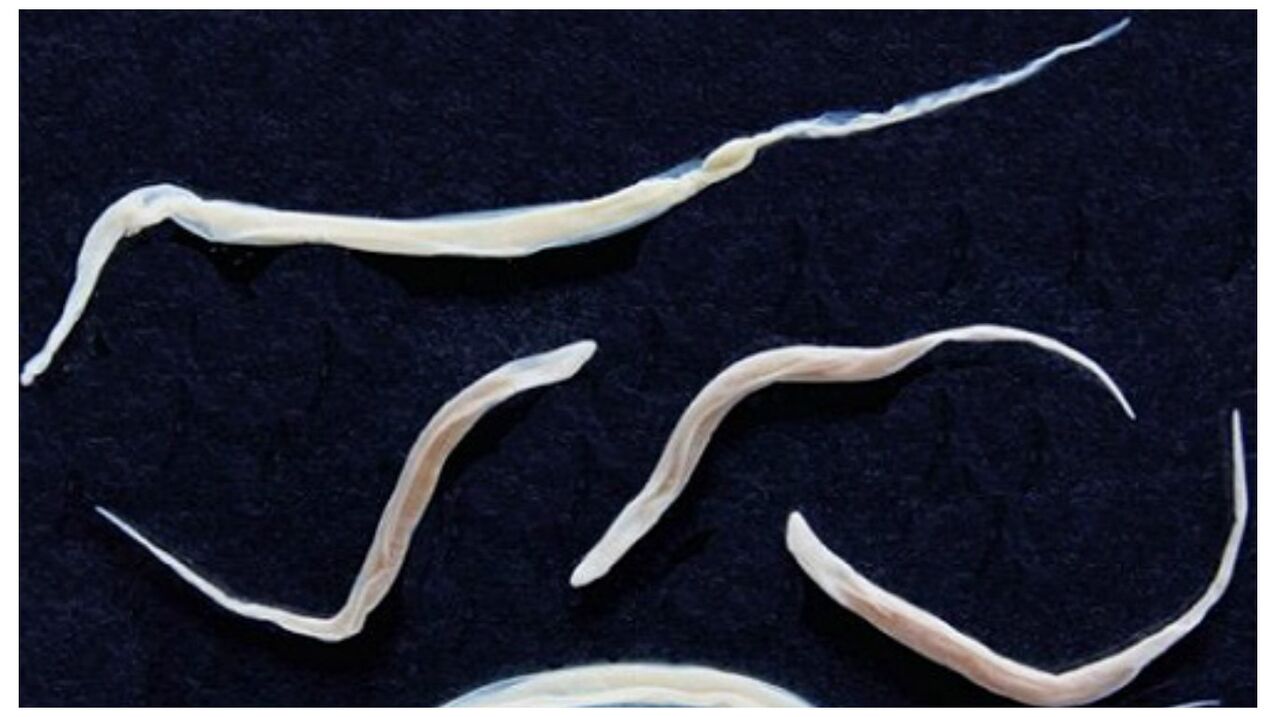 Pinworms sú bežné parazity patriace do skupiny helmintov.